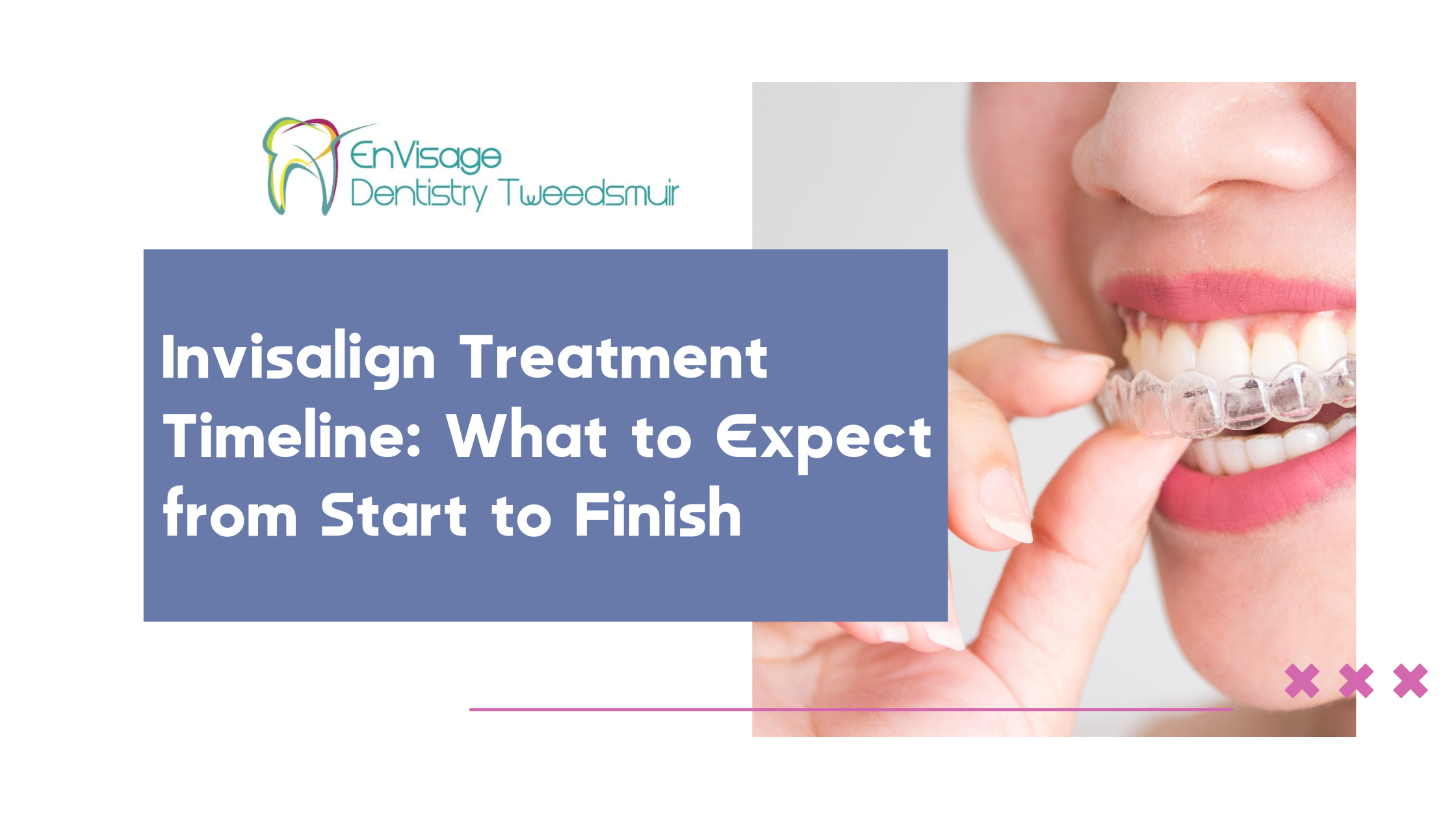 Invisalign Treatment Timeline: What to Expect from Start to Finish Invisalign Treatment Timeline: What to Expect from Start to Finish