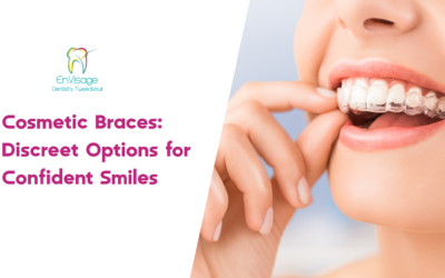 Cosmetic Braces: Discreet Options for Confident Smiles 