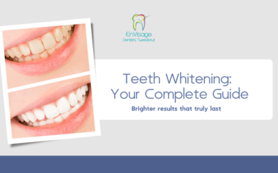 Teeth Whitening: What to Expect and How to Make Results Last 