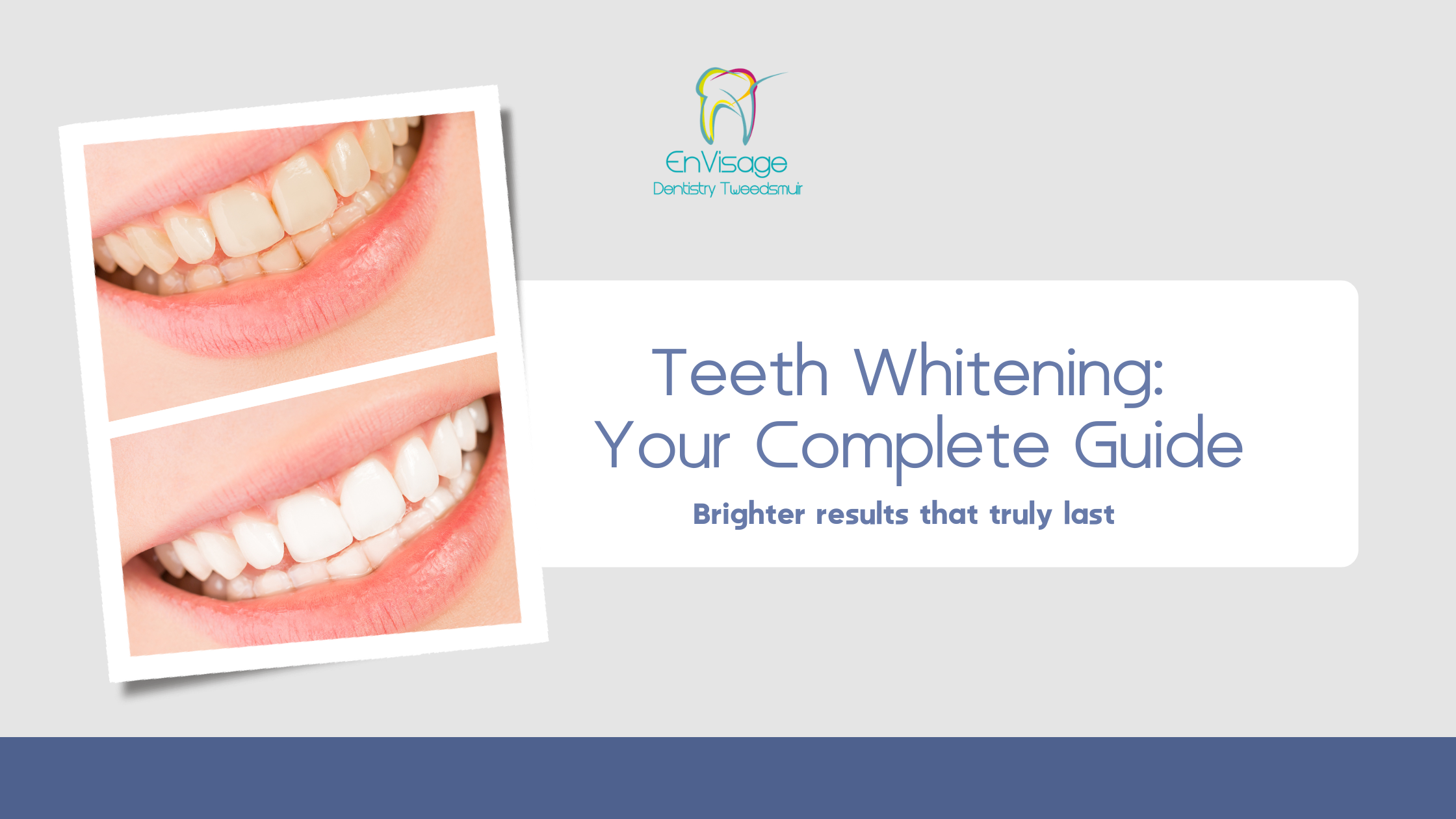 Teeth Whitening: What to Expect and How to Make Results Last