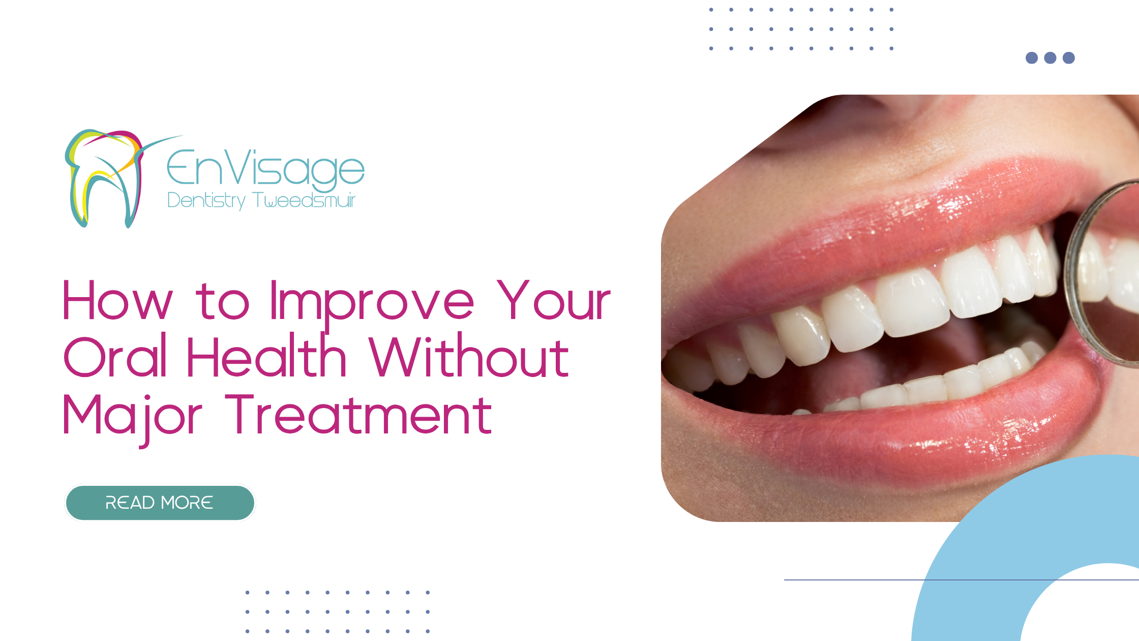 How to Improve Your Oral Health Without Major Treatment | Envisage Dentistry Tweedsmuir (Cardonald)