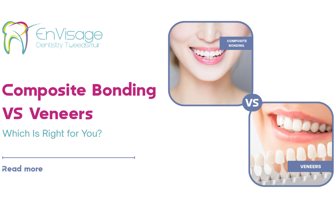 Composite Bonding vs Porcelain Veneers Which Is Right for You