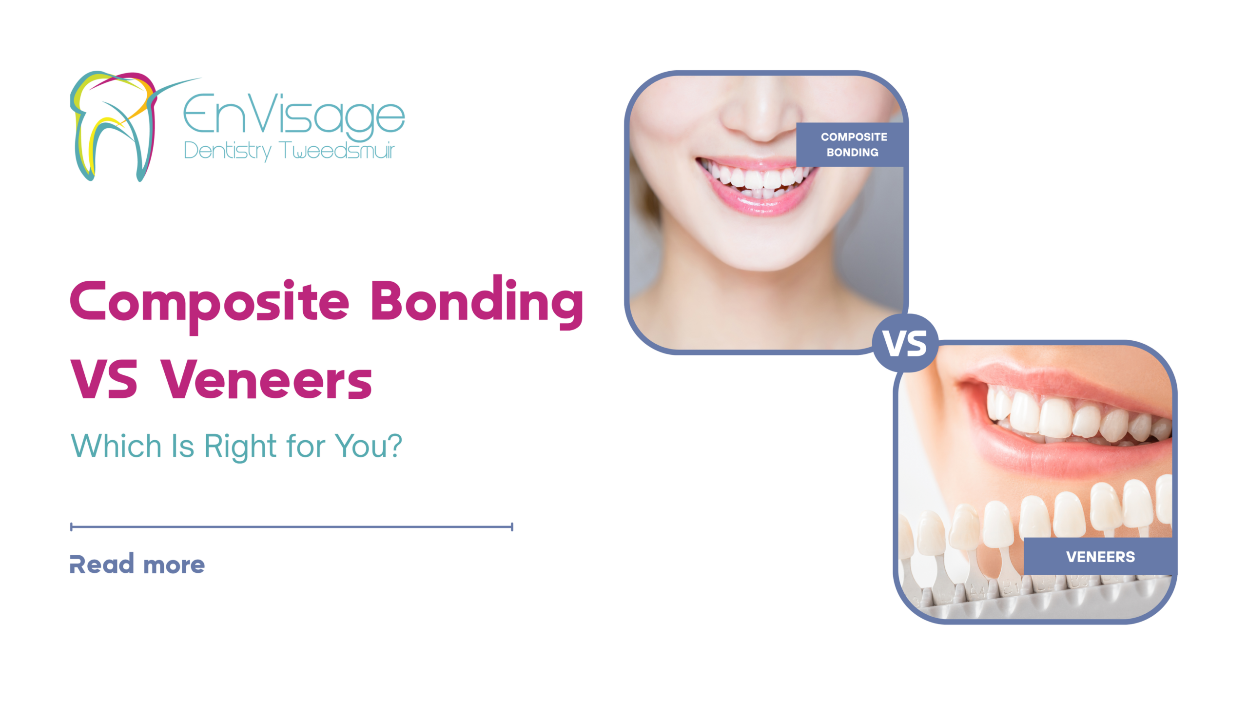 Tweedsmuir Composite Bonding vs Porcelain Veneers Which Is Right for You
